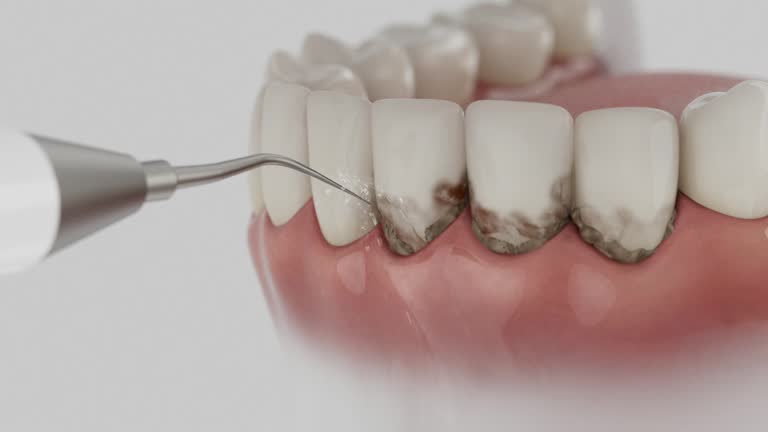 Trusted Root Canal Treatment service in Macomb, IL - Dentist Open Now